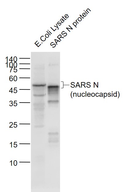 SARS-CoV Nucleocapsid