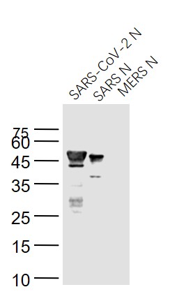 SARS-CoV Nucleocapsid