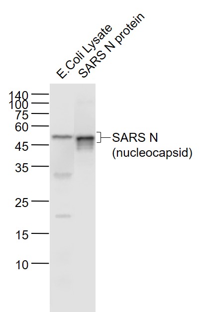 SARS-CoV Nucleocapsid