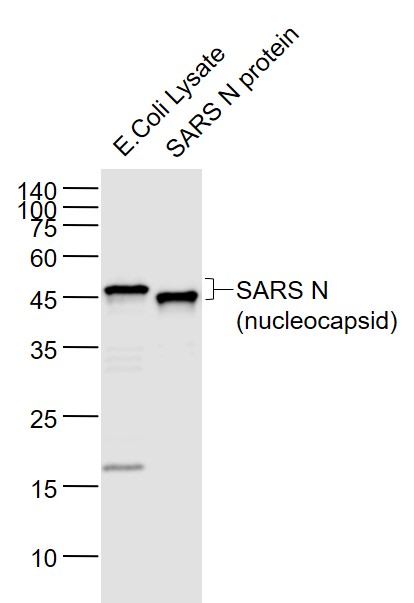 SARS-CoV Nucleocapsid
