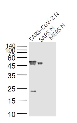SARS-CoV Nucleocapsid
