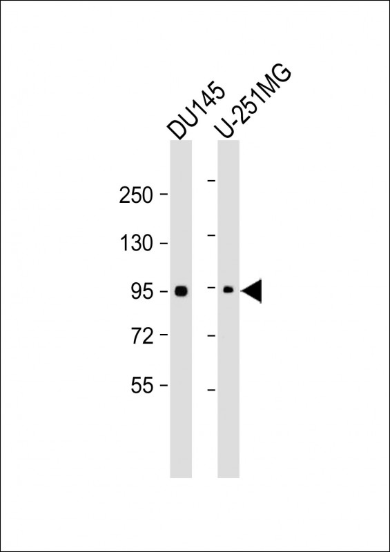 Glucocorticoid receptor Mouse mAb (一抗) - WB | Bioss