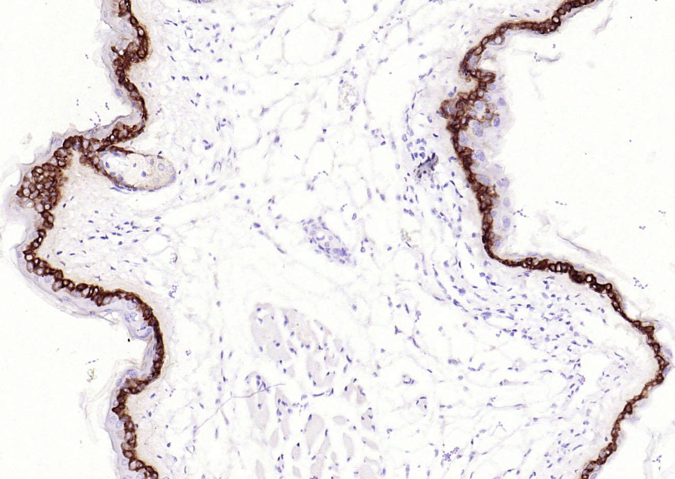 胶原蛋白17重组兔单抗