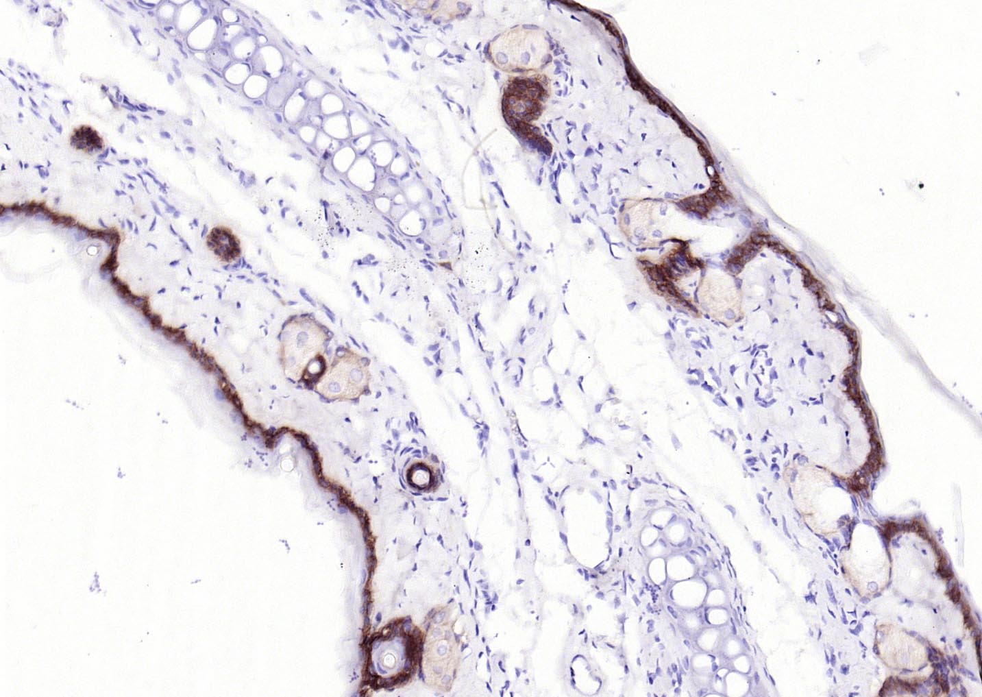 胶原蛋白17重组兔单抗