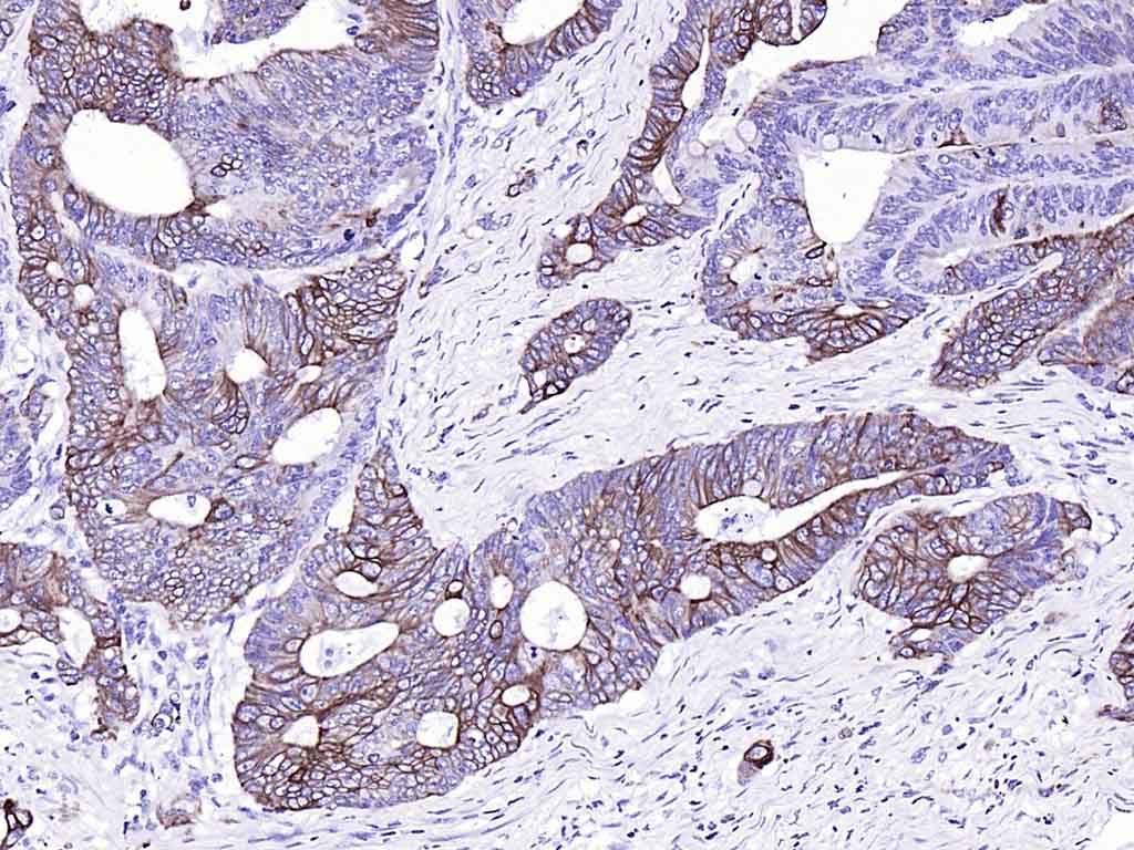 细胞角蛋白20重组兔单抗