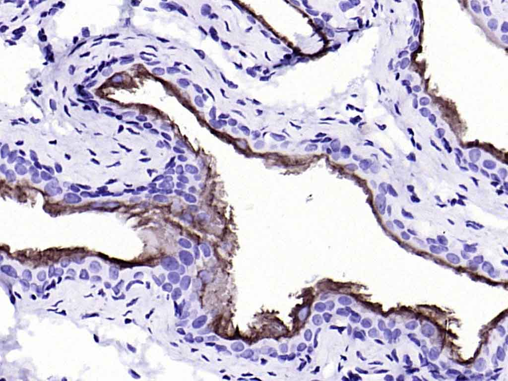 细胞角蛋白20重组兔单抗