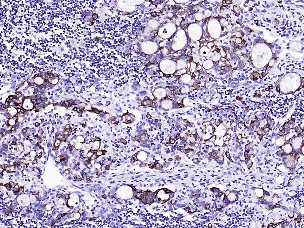 细胞角蛋白20重组兔单抗