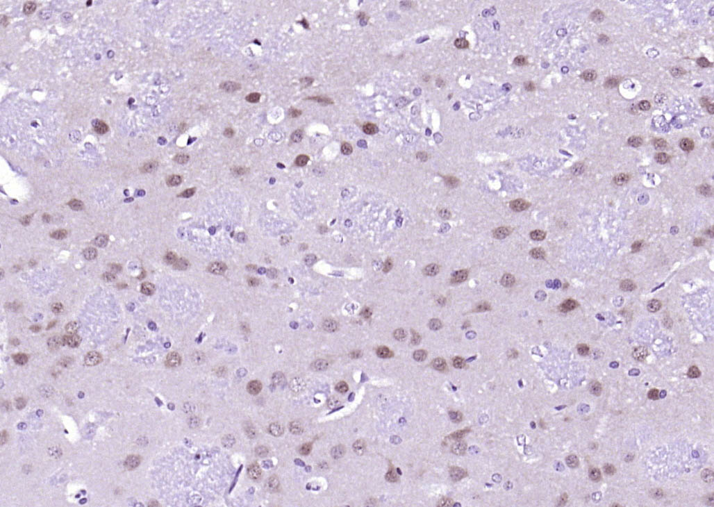 丝裂原活化蛋白激酶2重组兔单抗