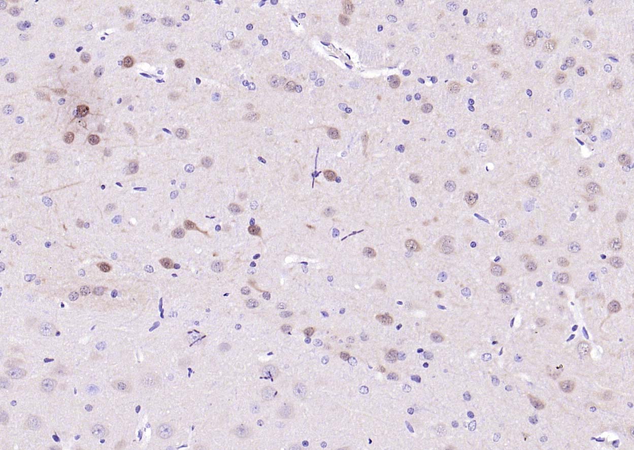 丝裂原活化蛋白激酶2重组兔单抗