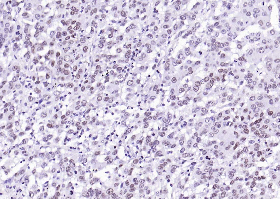 组蛋白H2AZ重组兔单抗