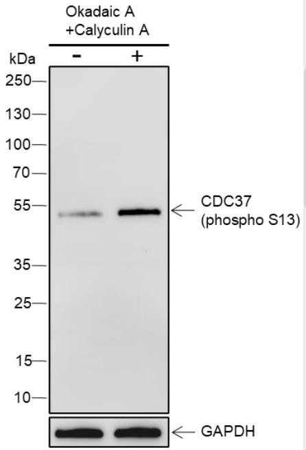 phospho-CDC37 (Ser13) Recombinant Rabbit mAb (一抗) | Bioss