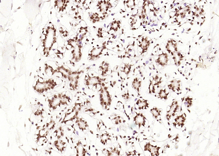 磷酸化雌激素受体ER alpha 重组兔单抗