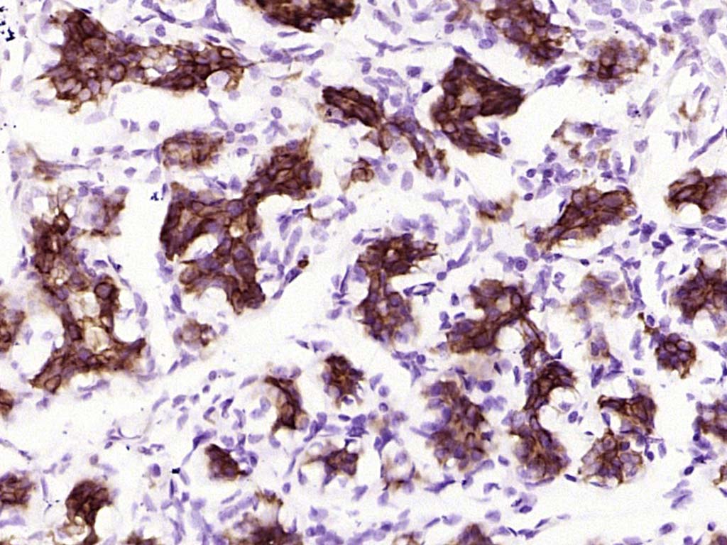 磷酸化糖原合酶激酶-3β重组兔单抗