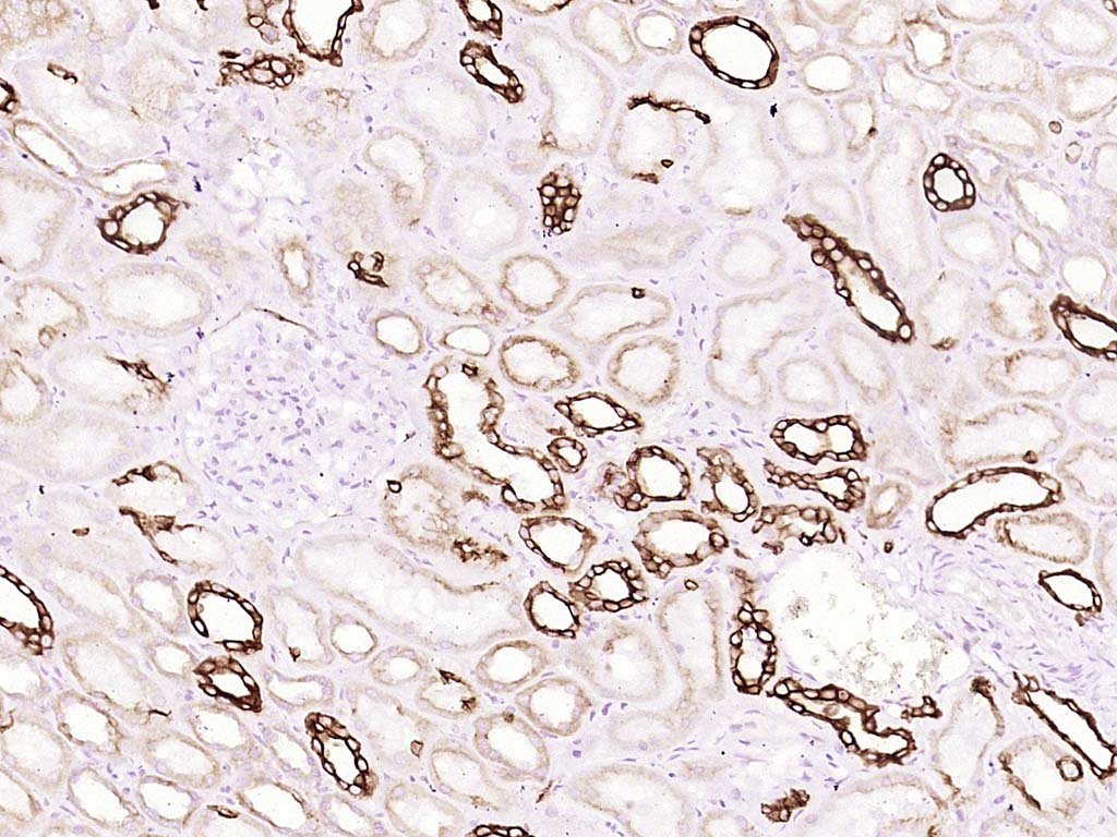 磷酸化糖原合酶激酶-3β重组兔单抗