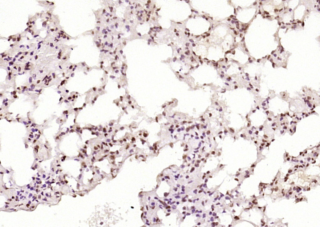 磷酸化热休克因子1重组兔单抗