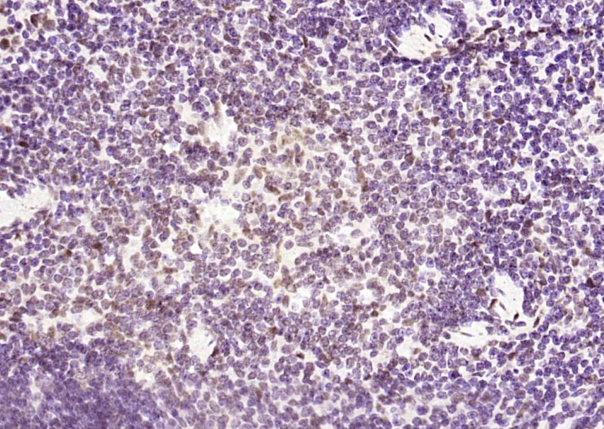磷酸化热休克因子1重组兔单抗