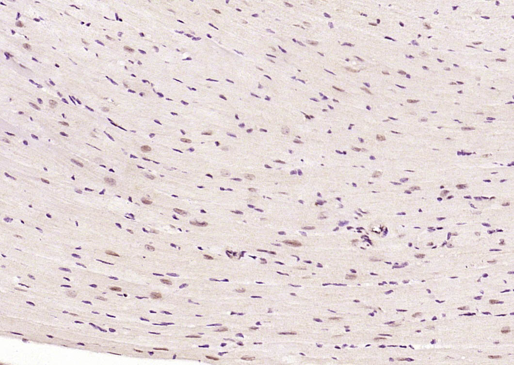 磷酸化热休克因子1重组兔单抗