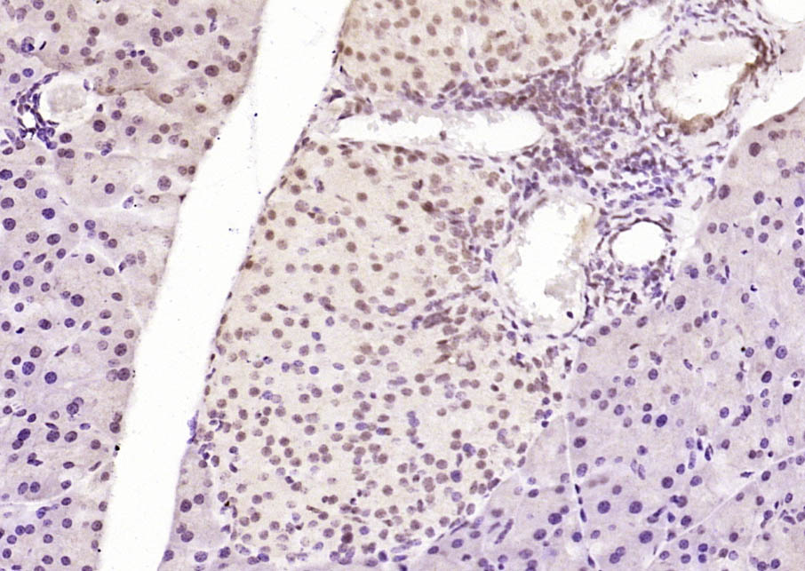 磷酸化热休克因子1重组兔单抗