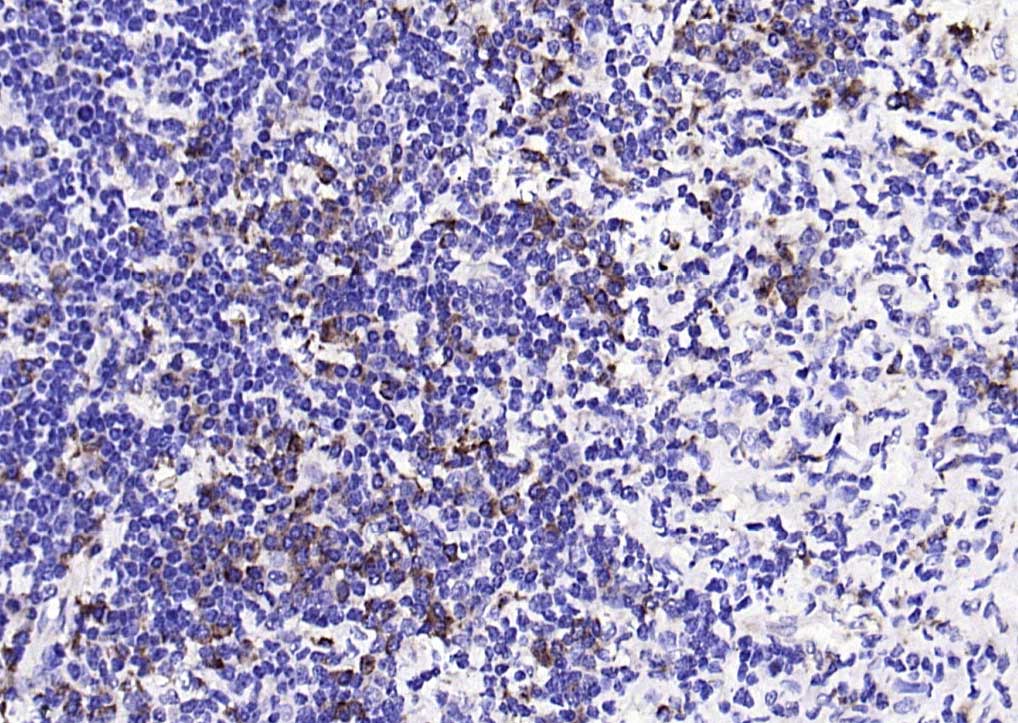 磷酸化干扰素诱导的双链RNA活化蛋白激酶重组兔单抗