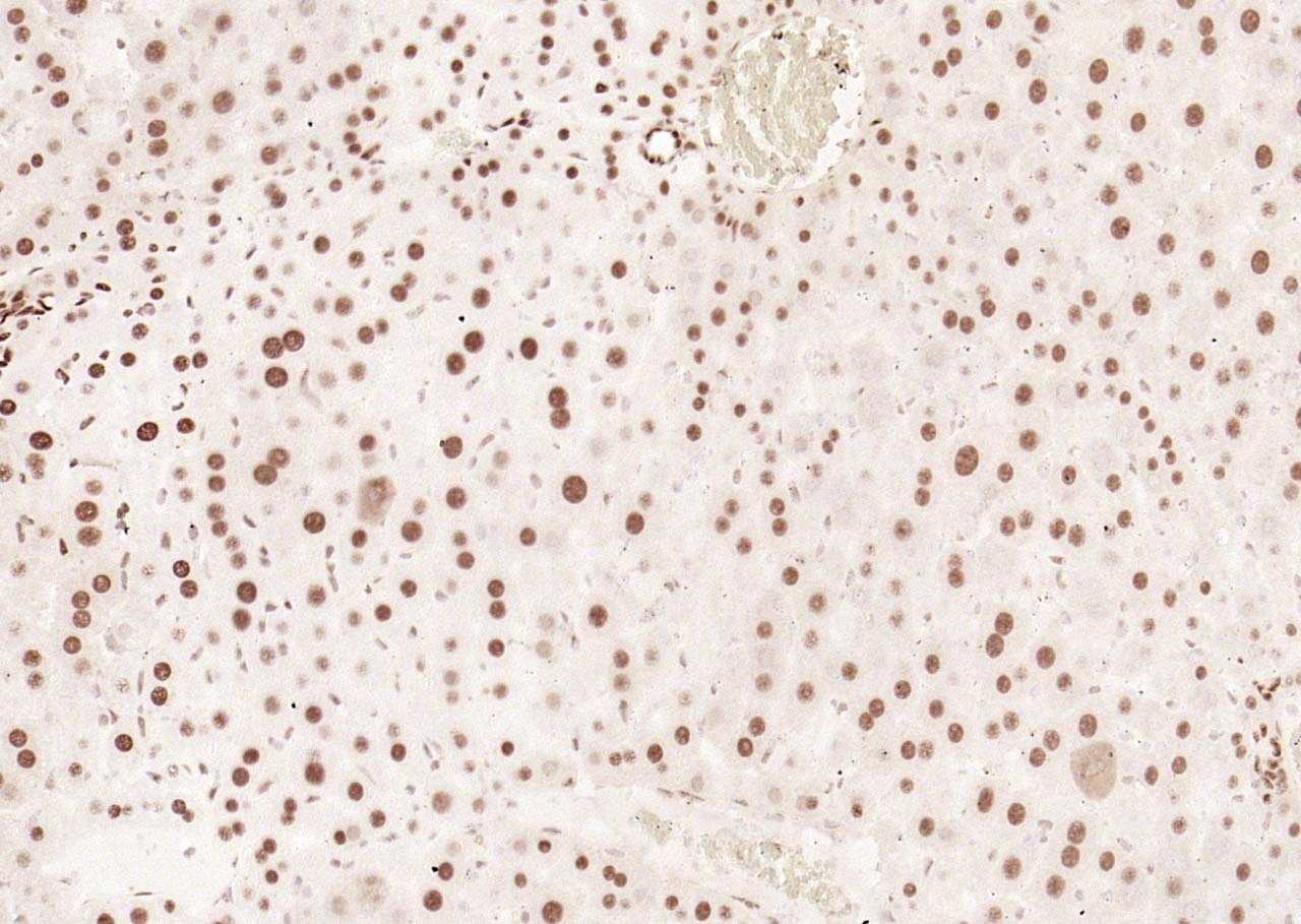 磷酸化细胞信号转导分子SMAD5重组兔单抗