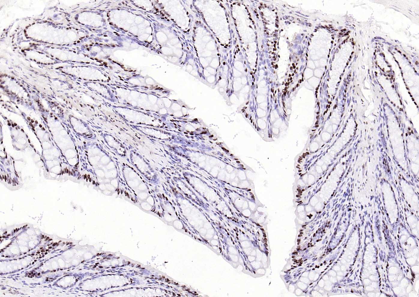 磷酸化细胞信号转导分子SMAD5重组兔单抗