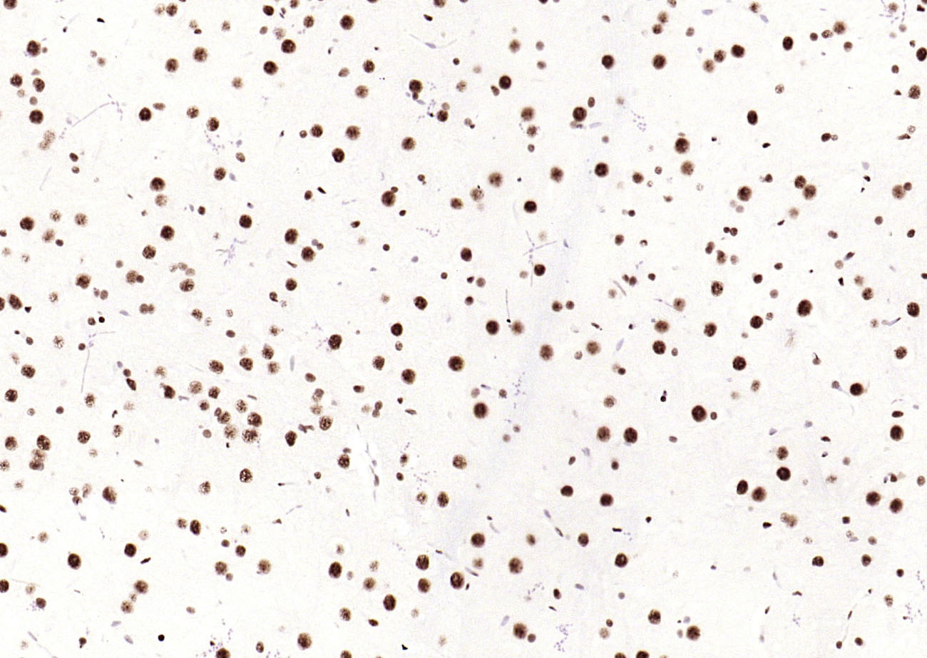 磷酸化细胞信号转导分子SMAD5重组兔单抗