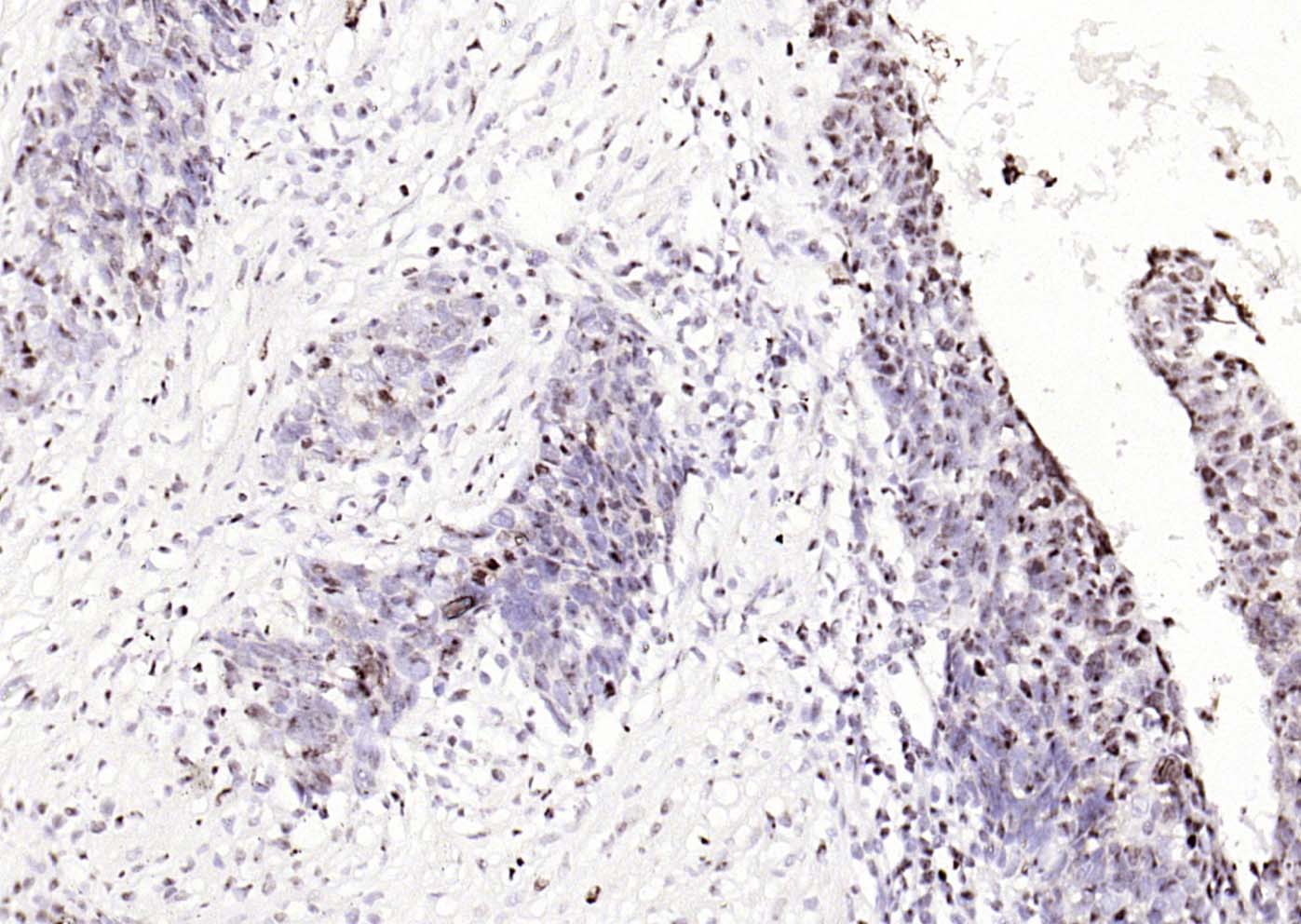 磷酸化细胞信号转导分子SMAD5重组兔单抗