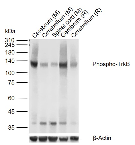 磷酸化酪氨酸激酶B(Tyr817)重组兔单抗