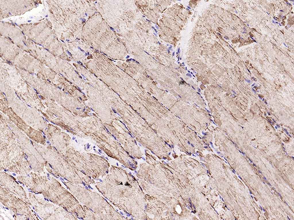 等电压依赖性阴离子通道（内参）重组兔单抗