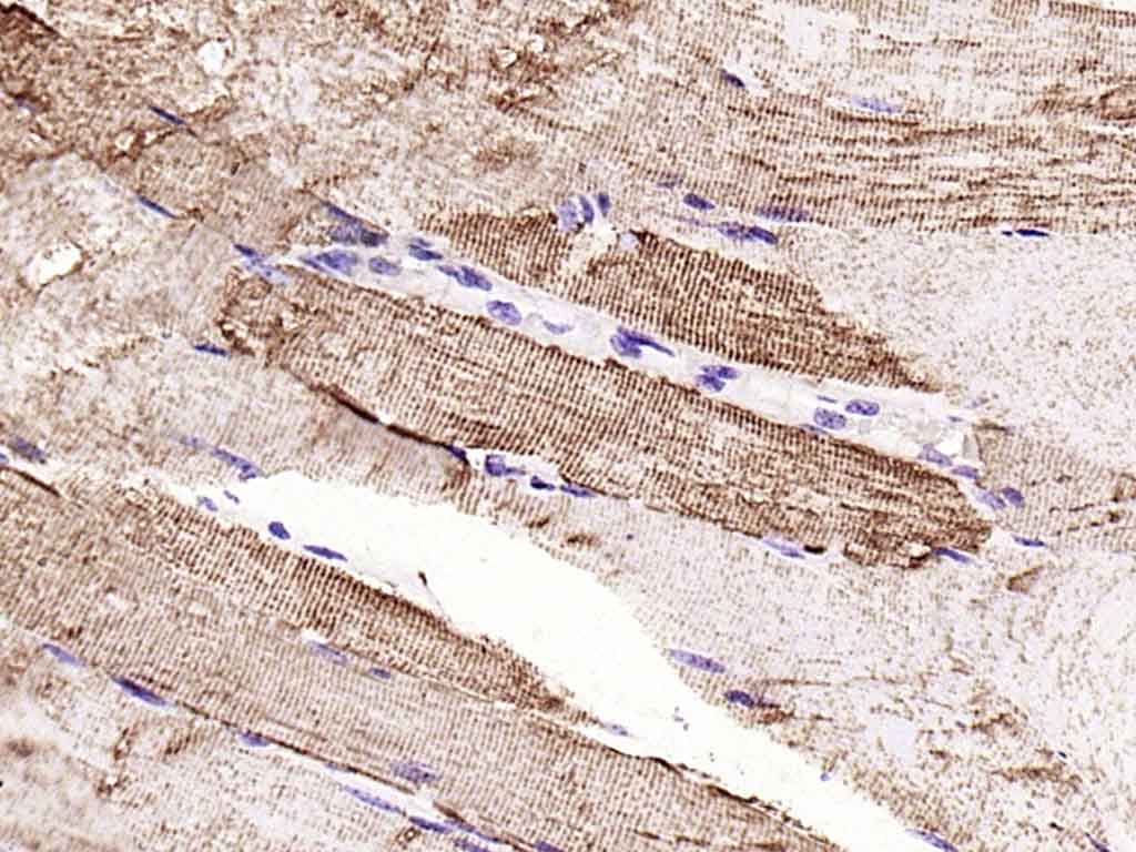 等电压依赖性阴离子通道（内参）重组兔单抗
