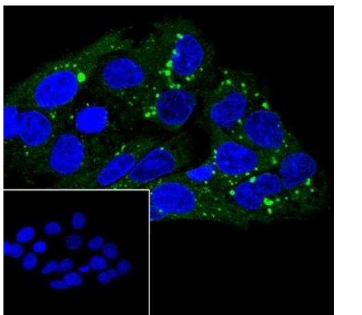 高密度脂蛋白受体/清道夫受体重组兔单抗