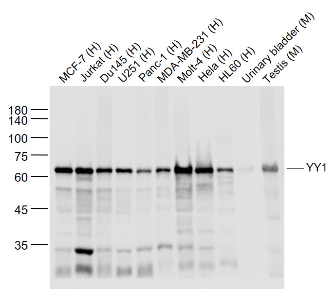 YY1 Recombinant Rabbit mAb, Nuclear Loading Control (一抗) - WB,IHC-P,IHC-F,IF,Flow-Cyt | Bioss