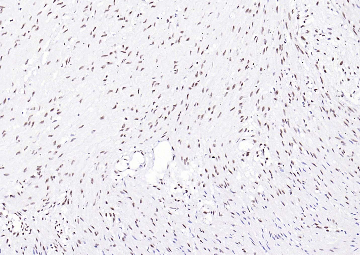 核转录调节因子YY1 （核内参）重组兔单抗-bsm-52349R