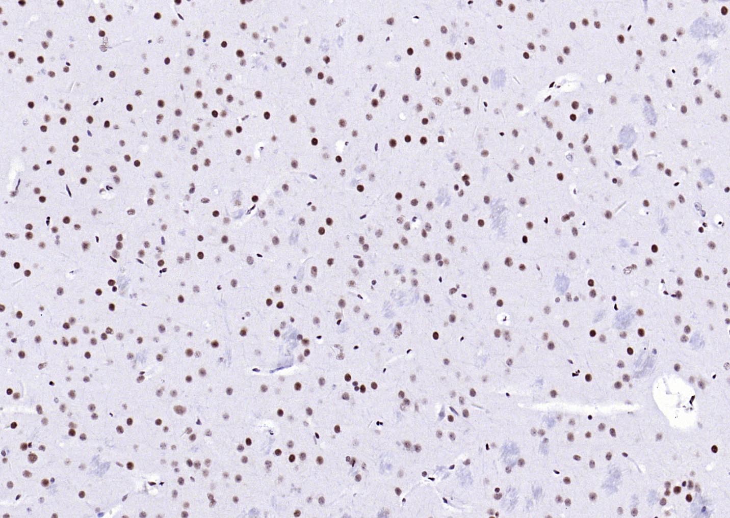 核转录调节因子YY1 （核内参）重组兔单抗-bsm-52349R