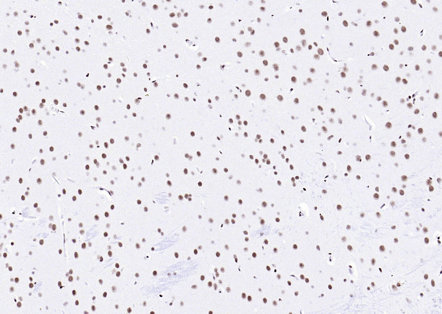 核转录调节因子YY1 （核内参）重组兔单抗-bsm-52349R