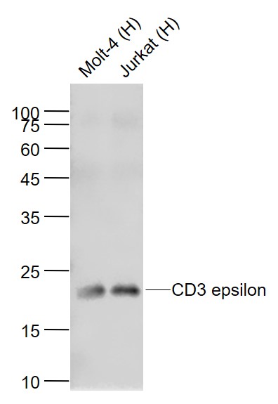 CD3 epsilon Recombinant Rabbit mAb (一抗) - WB,IHC-P,IHC-F,IF | Bioss