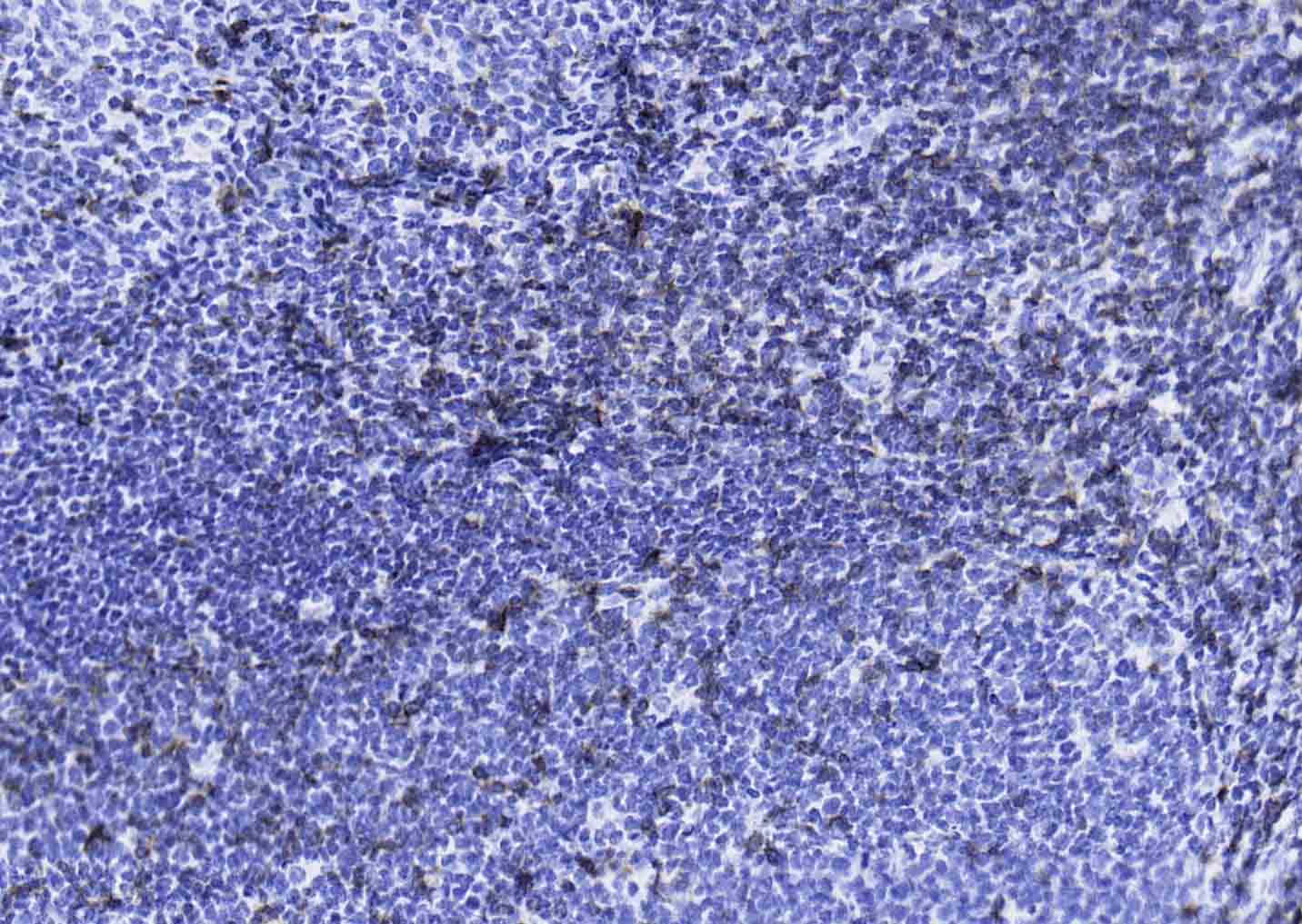 CD3E重组兔单抗-bsm-52386R