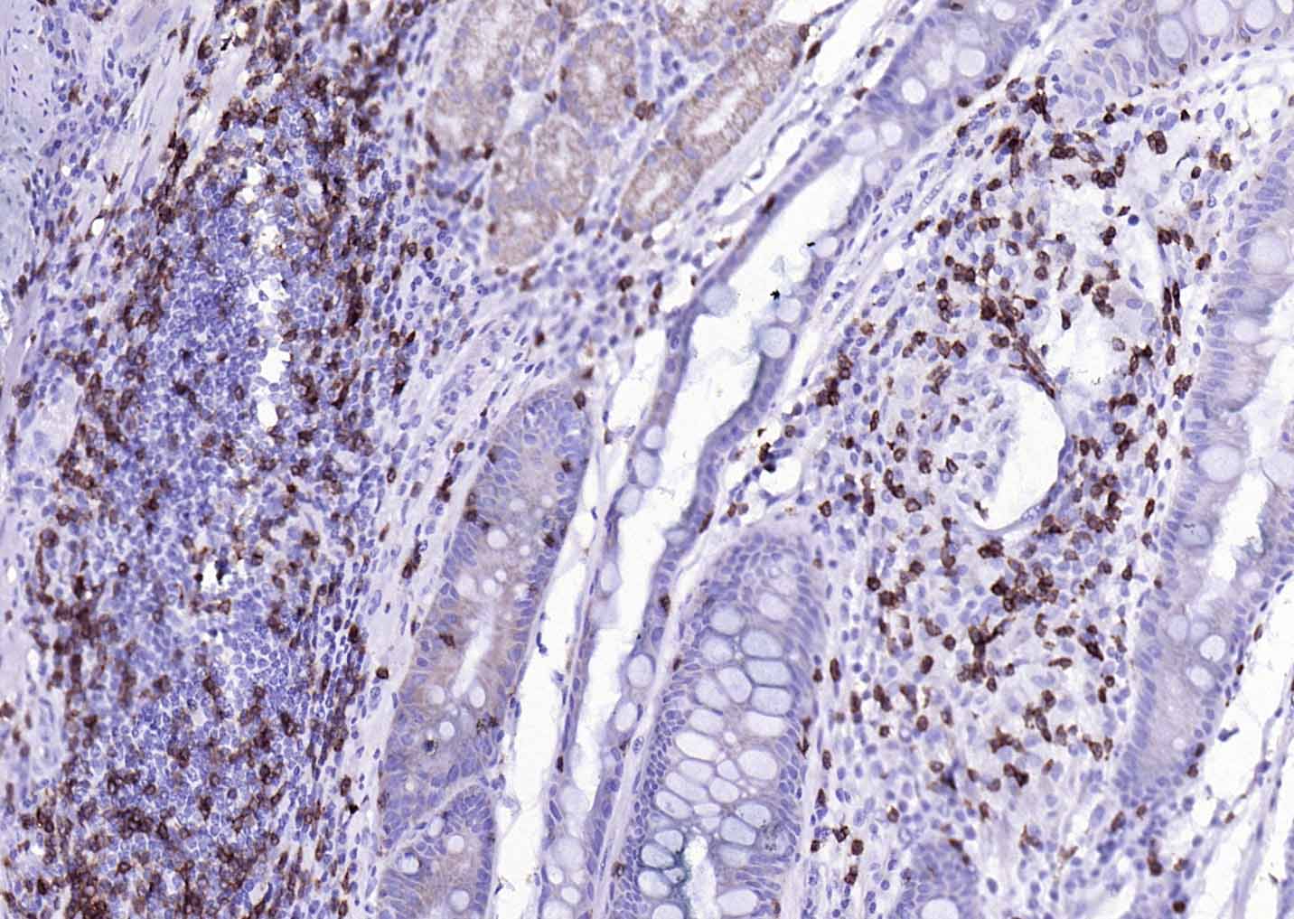 CD3E重组兔单抗-bsm-52386R