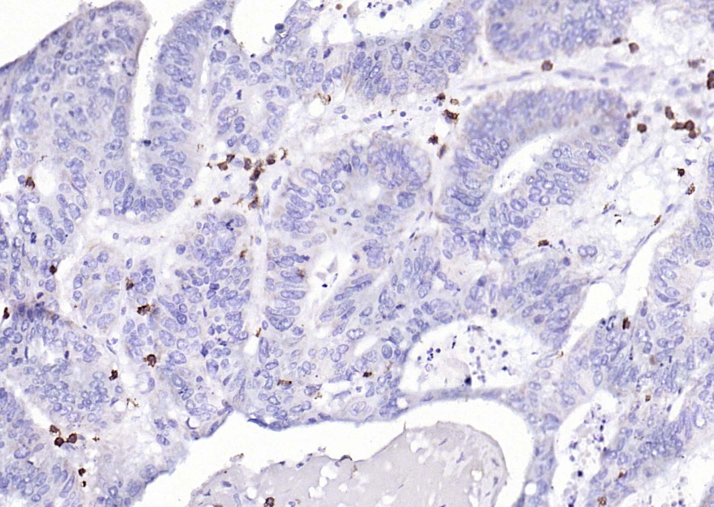 CD3E重组兔单抗-bsm-52386R