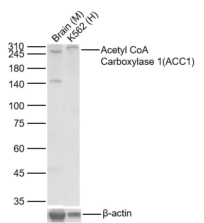 乙酰辅酶A羧化酶重组兔单抗