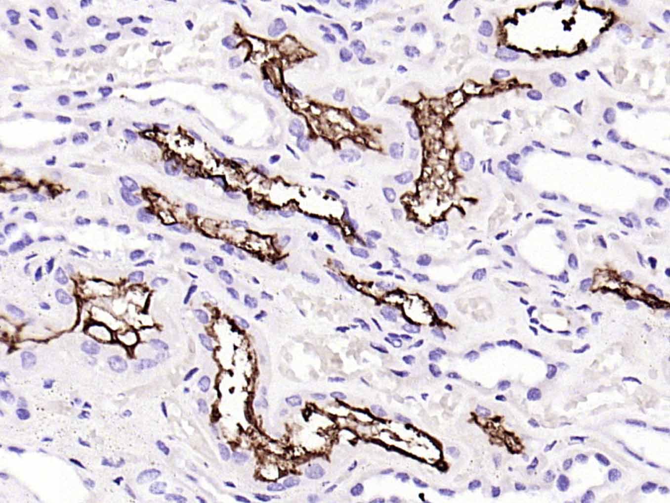 血管紧张素转换酶重组兔单抗