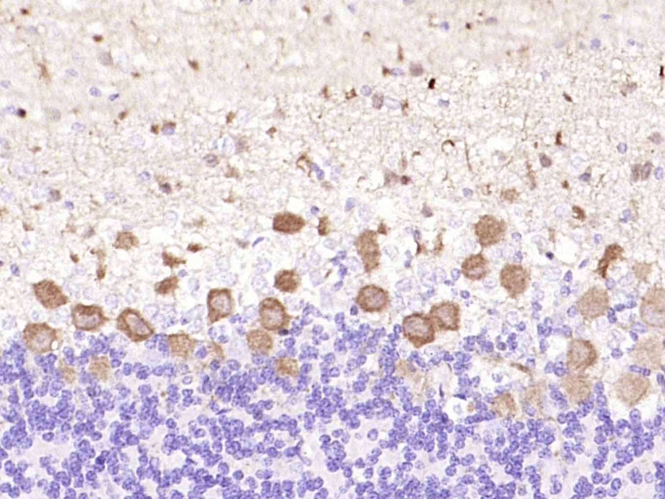 蛋白激酶C亚性D型重组兔单抗