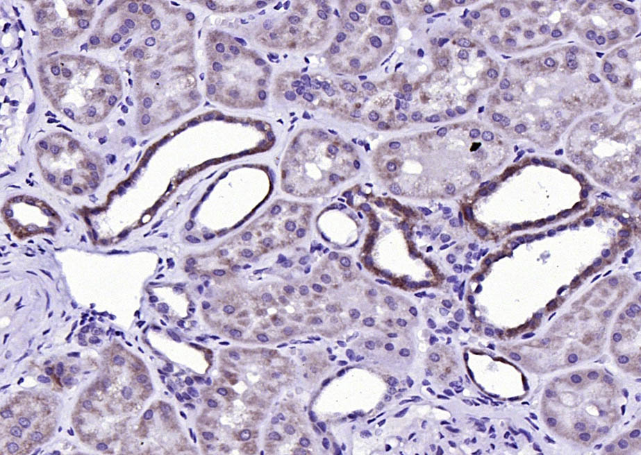 多巴胺受体D1重组兔单抗