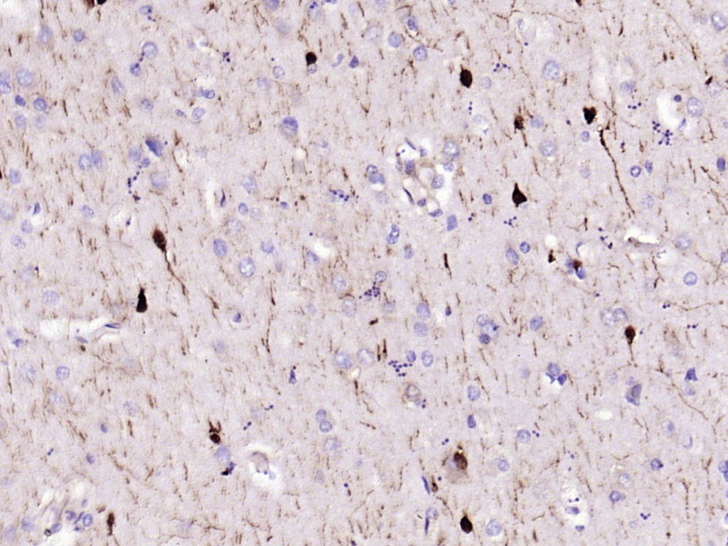 钙结合蛋白重组兔单抗