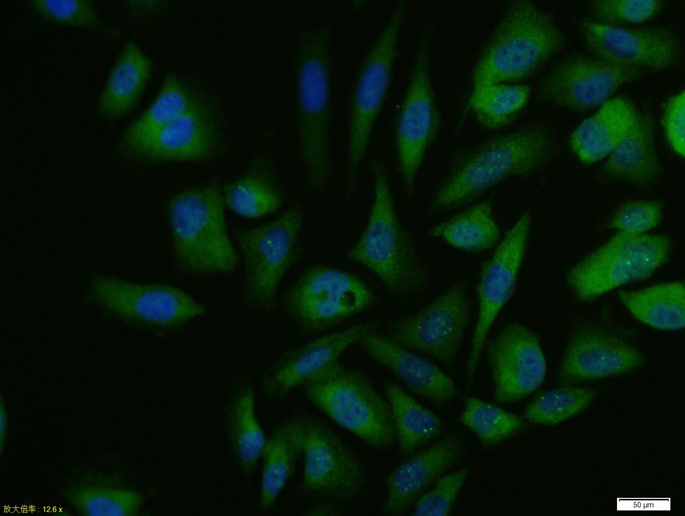 DNA结合抑制因子1重组兔单抗