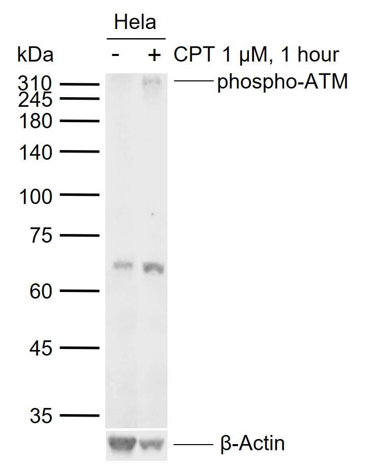 磷酸化ATM(Ser1981)重组兔单抗