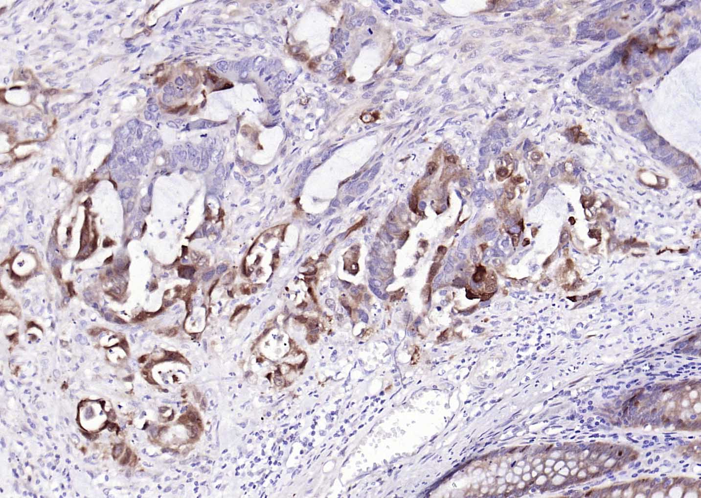BST2 Recombinant Rabbit mAb (一抗) - WB,IHC-P,IHC-F,IF,Flow-Cyt | Bioss