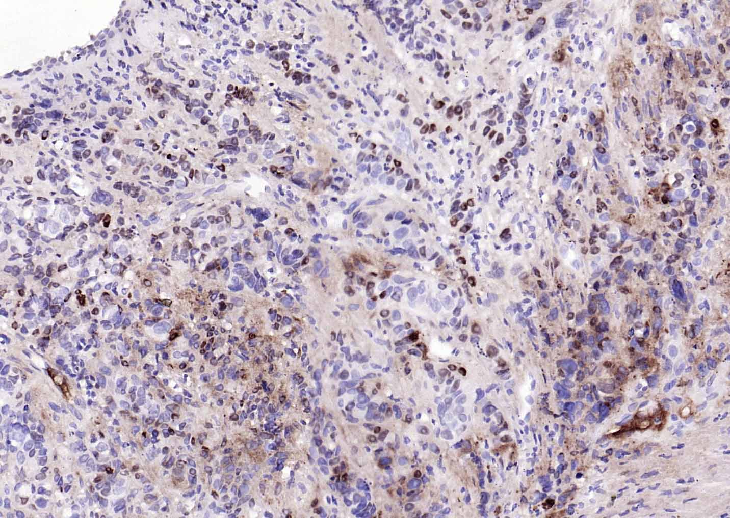 骨髓基质干细胞抗原2重组兔单抗-bsm-54196R
