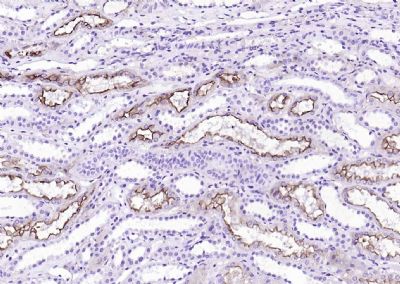 绒毛蛋白重组兔单抗