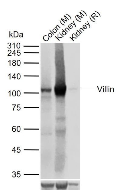 绒毛蛋白重组兔单抗